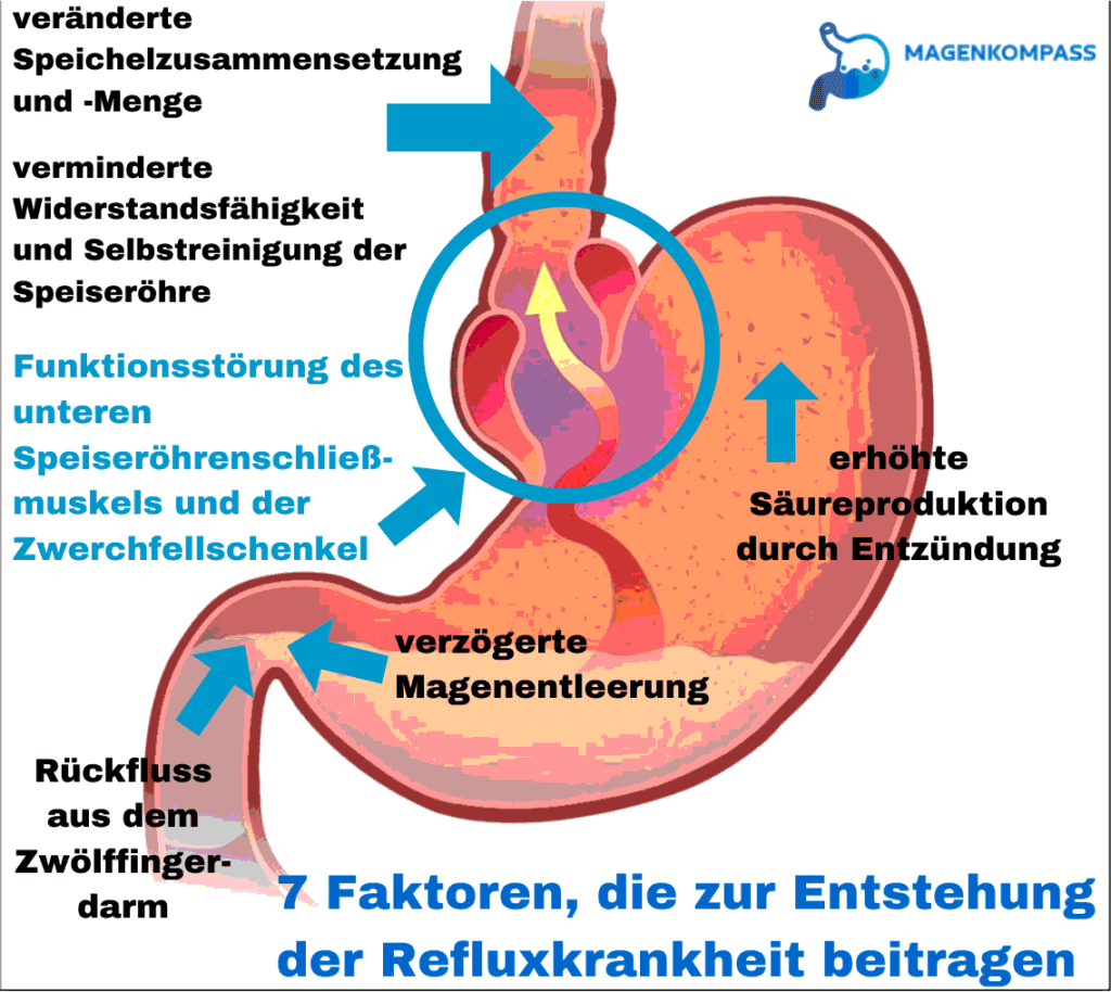Refluxkrankheit- - Entstehung