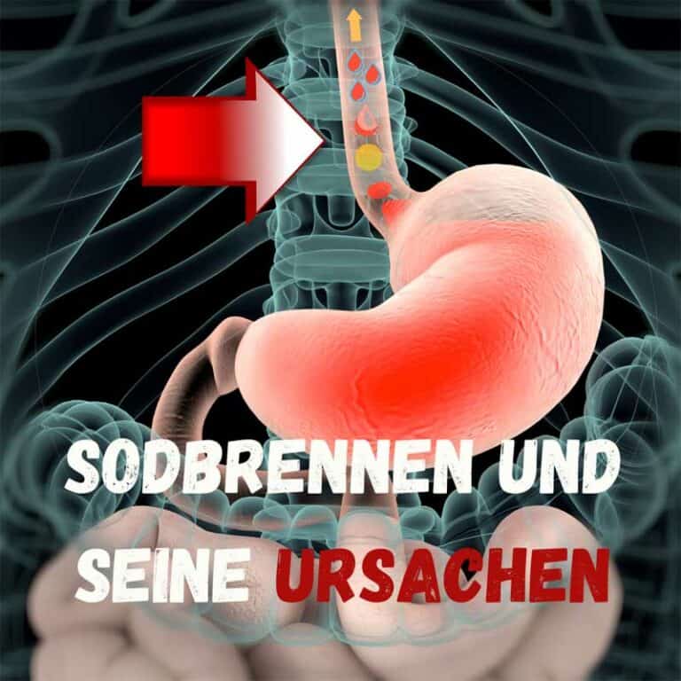 Sodbrennen Ursachen
