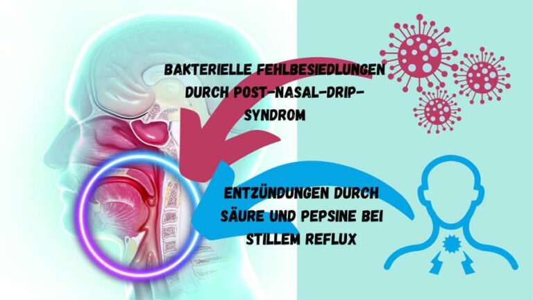 post-nasal-drip-syndrom-und-stiller-reflux