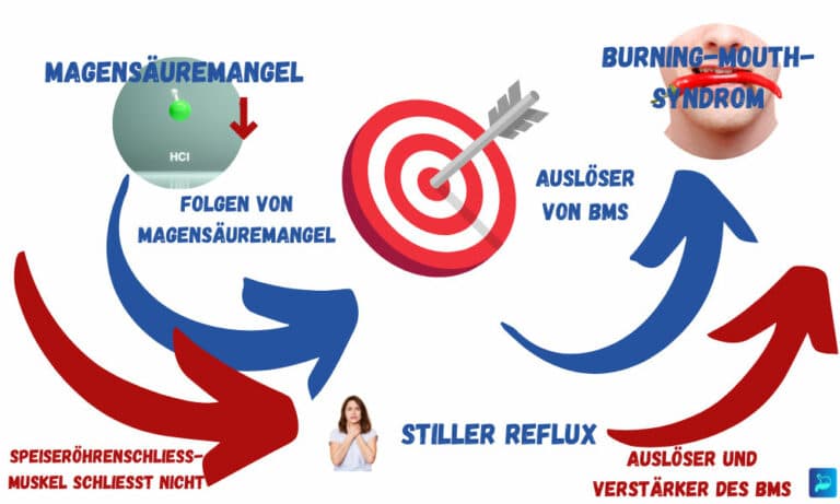 Burning-Mouth-Syndrom und Stiller Reflux