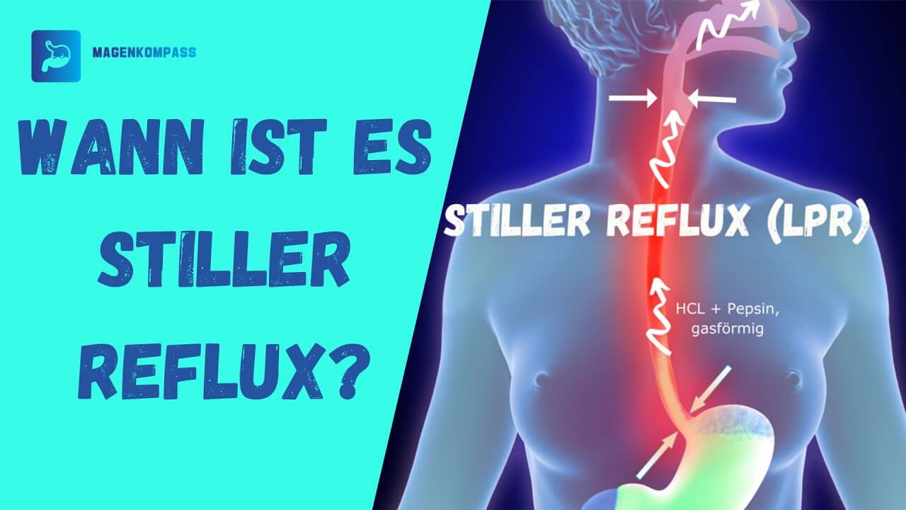 Wann ist es Stiller Reflux Bildabdeckung Wann ist es Stiller Reflux