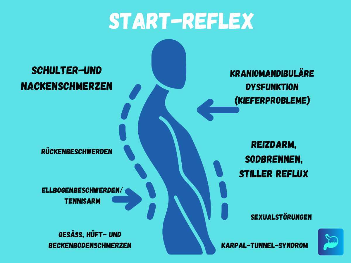 Star-Reflex und Stiller Reflux