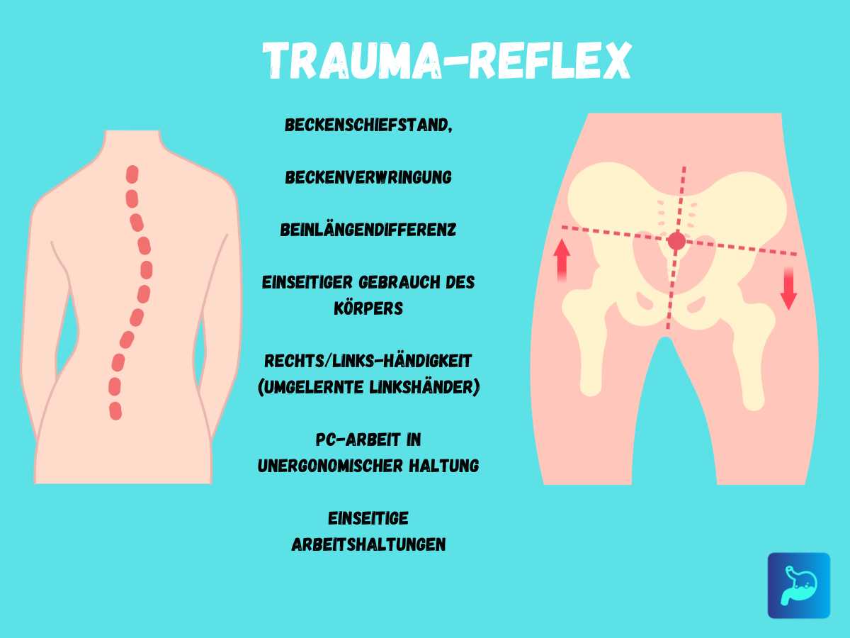 Trauma-Reflex und Stiller Reflux