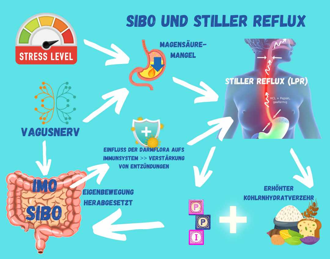 Zusammenhang zwischen SIBO und Stillem Reflux