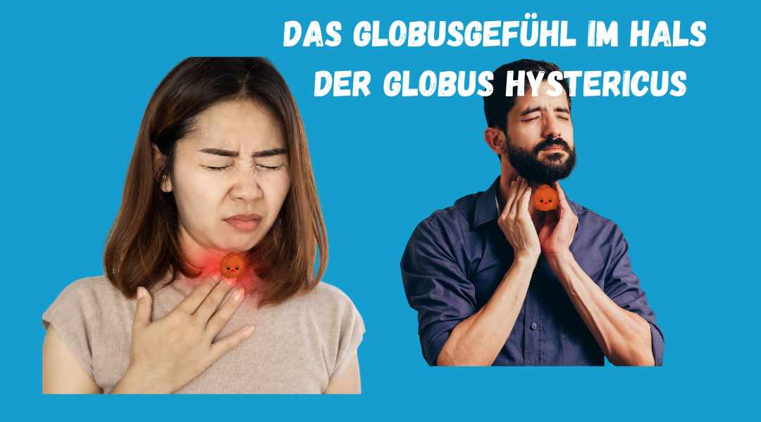 Globus hystericus