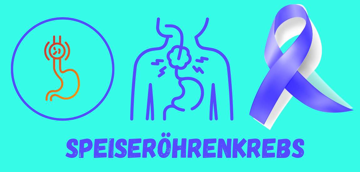 Speiseröhrenkrebs Speiseröhrenkrebs