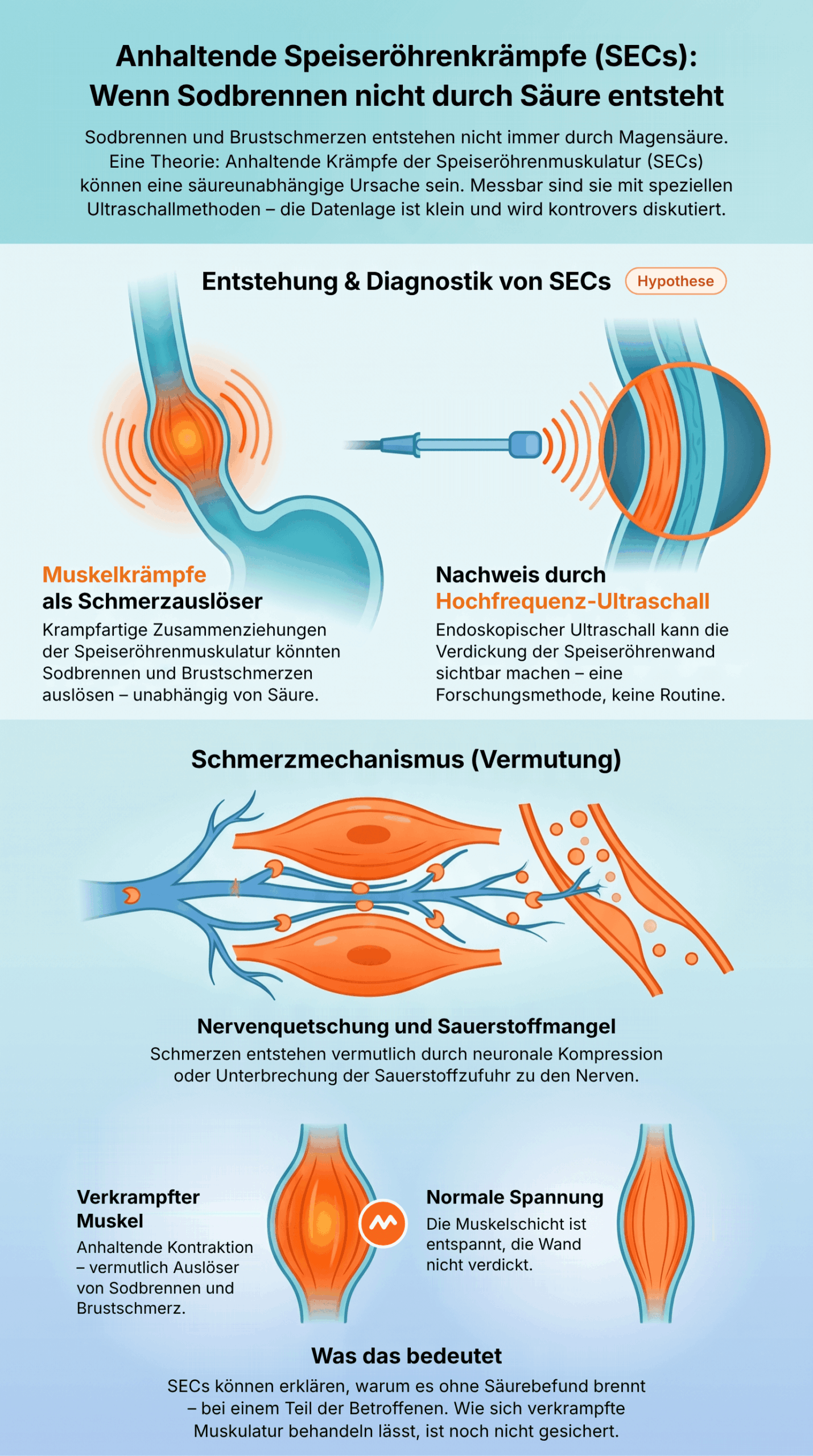 Infografik_SEC_korrigiert_v1