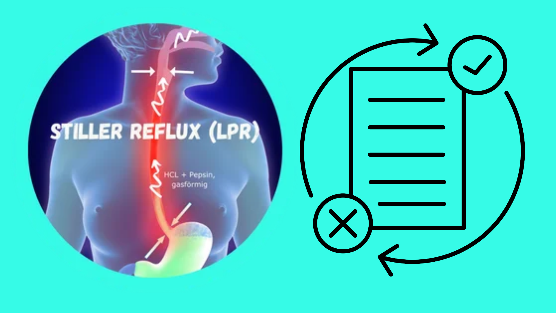Stiller Reflux und die Leitlinie